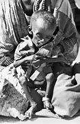 Image result for Starving Ethiopian Child