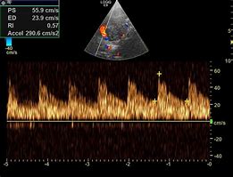 Image result for CTP Testing