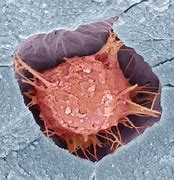 Image result for Osteoblasts in Bone