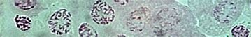 Image result for Double Haploid