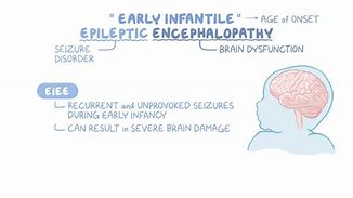 Image result for Pediatric Encephalopathy