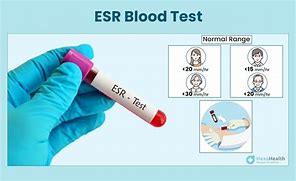 Image result for ESR Blood Test Icon