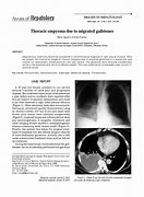 Image result for Thoracic Empyema