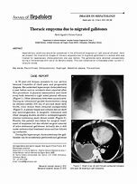 Image result for Empyema Thoracic Ultrasound