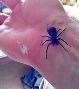 Image result for A Black Widow Spider Bite