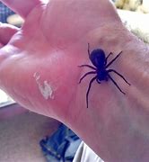 Image result for Black House Spider Bite