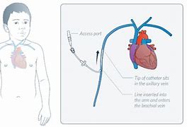 Image result for Midline Example