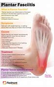 Image result for Plantar Fascia Ligament Pain