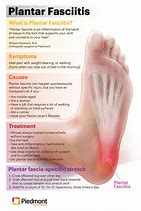 Image result for Plantar Arch