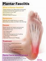 Image result for Plantar Arch