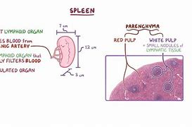 Image result for Spleen Metastasis