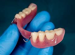 Image result for Metal-Based Partial Dentures