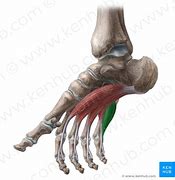 Image result for M Flexor Digiti Minimi Brevis