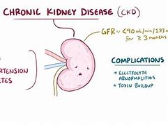 Image result for Chronic Kidney Disease