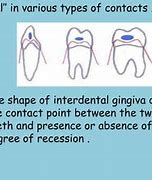 Image result for Col Gingiva