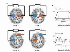 Image result for tDCS Placement Map