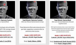 Image result for tDCS Placement Map