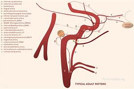 Image result for Middle Meningeal Artery Grove of Skull