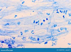 Image result for Bacterium Mycobacterium Tuberculosis