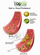 Image result for Home Remedies for Cholesterol