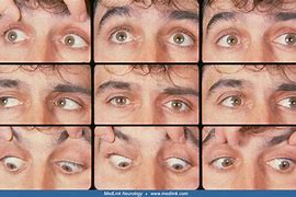 Image result for What Gaze