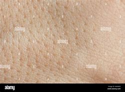 Image result for Skin Pores Up Vlose