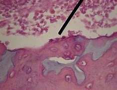 Image result for Osteoblasts in Bone