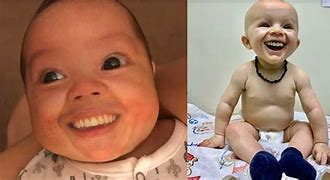 Image result for Baby Teeth Meme