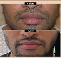 Image result for Lip Reaidng