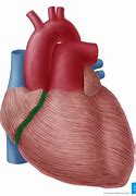 Image result for Posterior Interventricular Sulcus