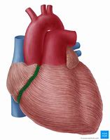 Image result for Atrioventricular Coronary Sulcus