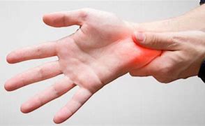 Image result for Outer Wrist Pain