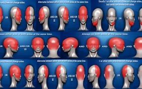 Image result for Headache Left Side of Head