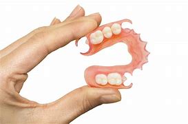 Image result for Metal-Based Partial Dentures