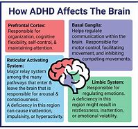 Image result for ADHD Syndrome