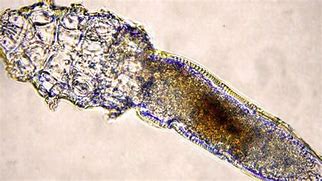 Image result for Face Mites in Pores