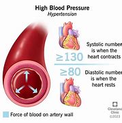 Image result for High Blood Pressure Arteries