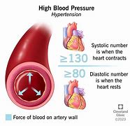 Image result for High Blood Pressure Treatment