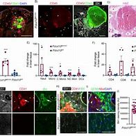 Image result for Cd45 Brain