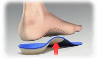 Image result for Plantar Fasciitis Orthotics