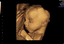 Image result for Mother 4D Baby Scan