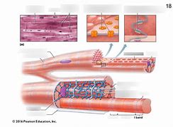 Image result for Cardiac Muscle Bundles