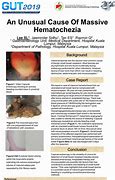 Image result for Hematochezia Ddx IBD