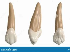 Image result for Maxillary Canine Pulp