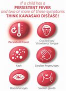 Image result for Kawasaki Virus Symptoms