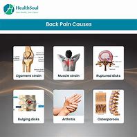 Image result for Back Pain Chart