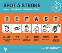 Image result for Stroke Victims