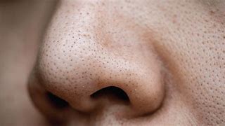 Image result for Human Skin Pores