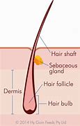 Image result for Hair Follicle Anatomy