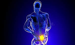 Image result for Sacral Spine Pain